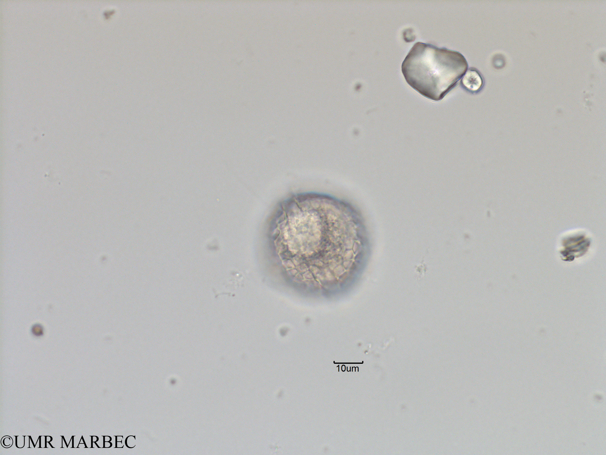 phyto/Bizerte/bizerte_bay/RISCO November 2015/Protoceratium spinulosum (Baie_T5-ACW1-Protoceratium reticulatum-2).tif(copy).jpg